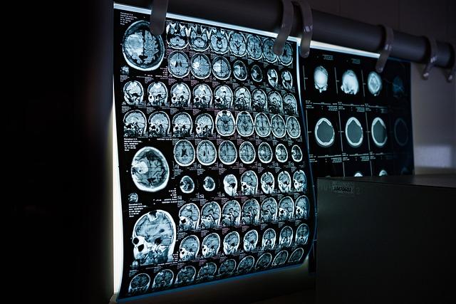 Are healthcare costs the biggest threat to a secure retirement